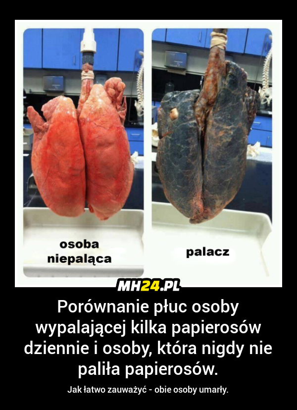 Porównanie płuc palacza i osoby nie palącej